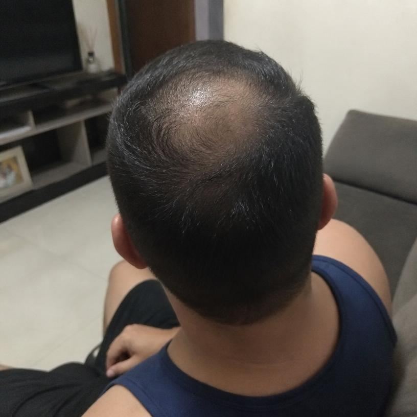 Antes — Marcos, 41 — MG