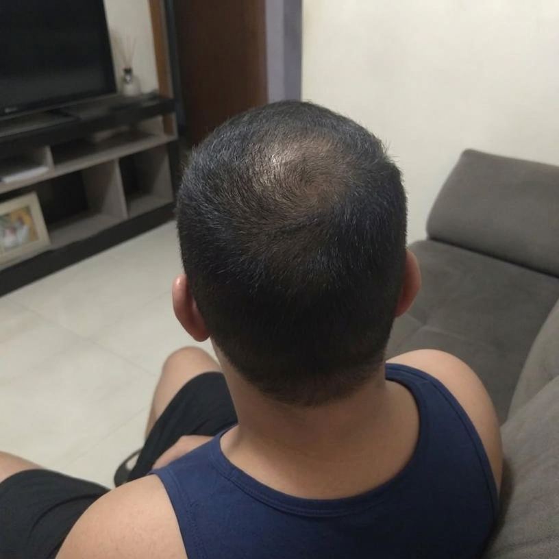Depois — Marcos, 41 — MG