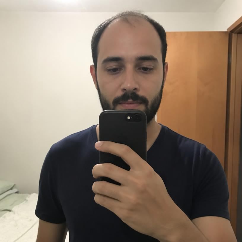 Antes — Diego, 28 — PR