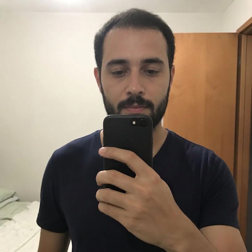 Depois — Diego, 28 — PR