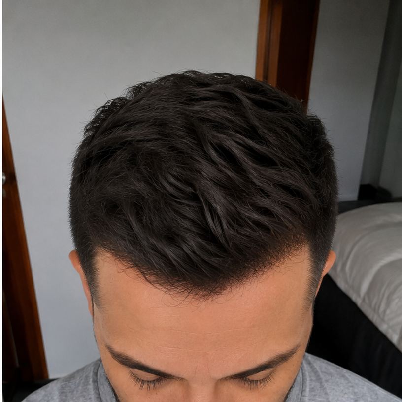 Depois — Vinícius, 31 — RJ